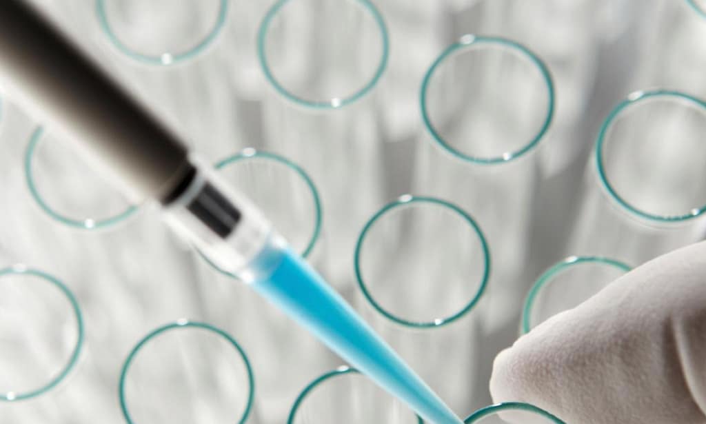 Diagnóstico y tratamiento del déficit de alfa 1- antitripsina