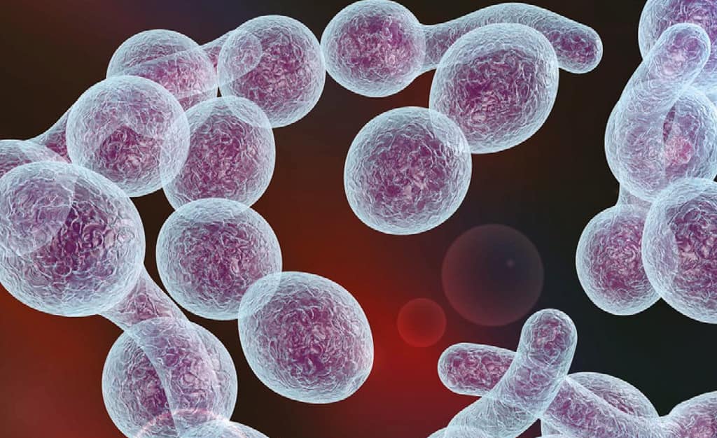 Efectividad del sistema de puntuación de Nugent en el diagnóstico de vaginosis bacteriana