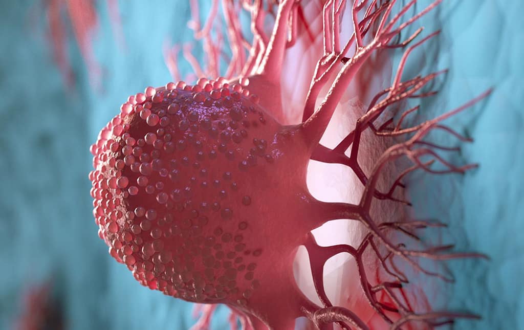 ICMT como potencial biomarcador en el cáncer