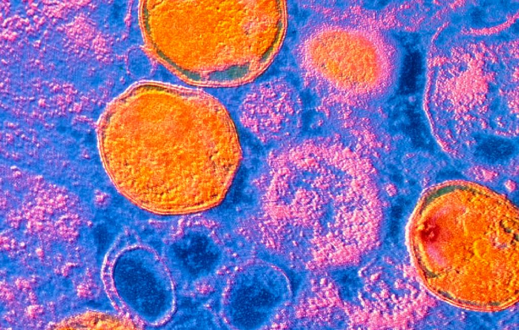 Susceptibilidad antimicrobiana en muestras urogenitales de Ureaplasma urealyticum, el principal agente en infección intramaniótica