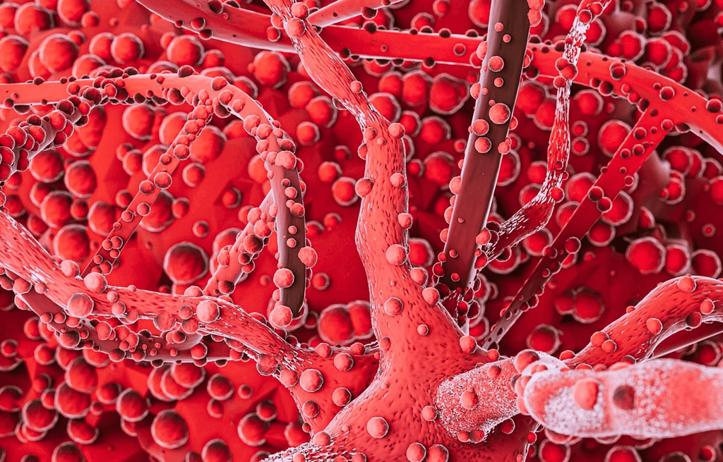 Enfermedad de Von Willebrand adquirida en un Mieloma múltiple: reporte de caso