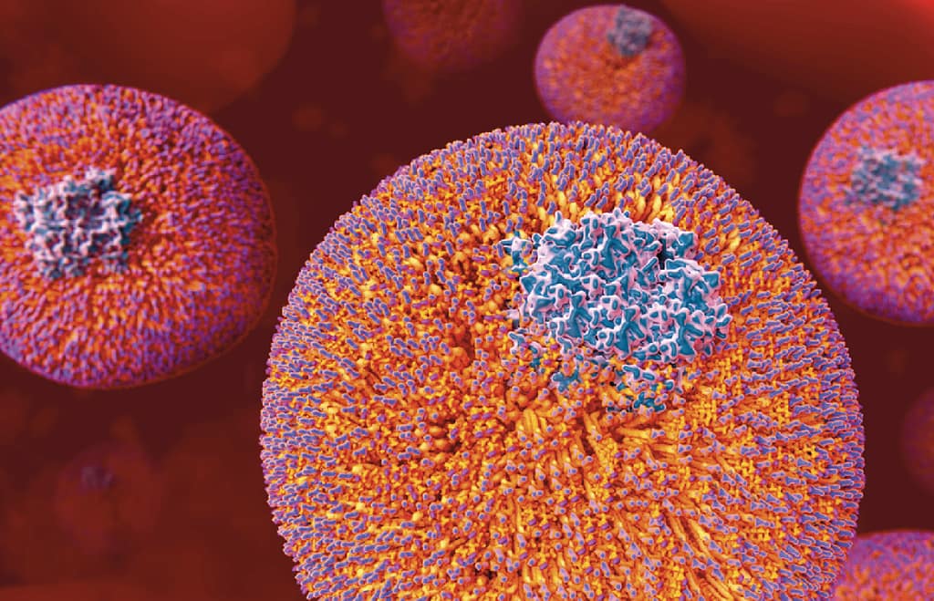 ¿Qué debe saber el cardiólogo clínico sobre la lipoproteína (a)?