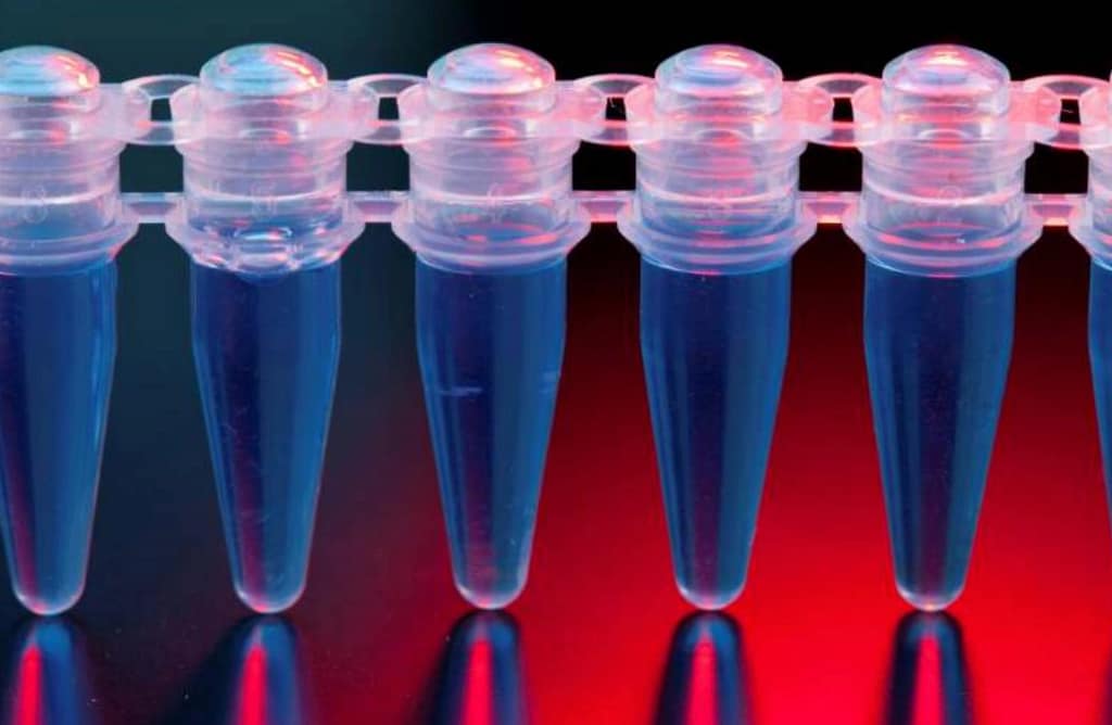 Fisiopatología, diagnóstico y tratamiento de la enfermedad de Whipple