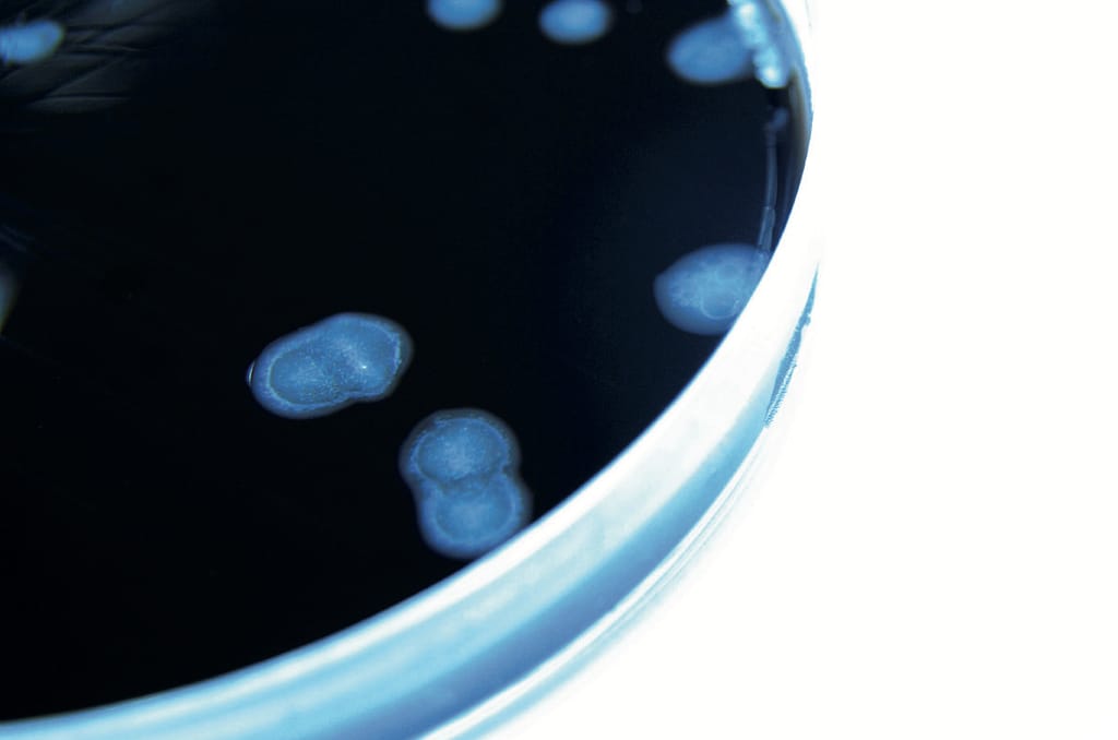 Resistencia transferible a quinolonas en enterobacterias productoras de BLEE en un hospital pediátrico del Uruguay