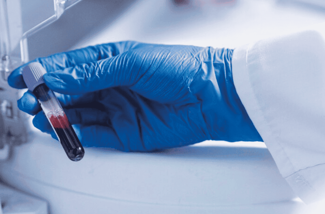 Reducir costos, elevan calidad para un obtener un laboratorio eficiente