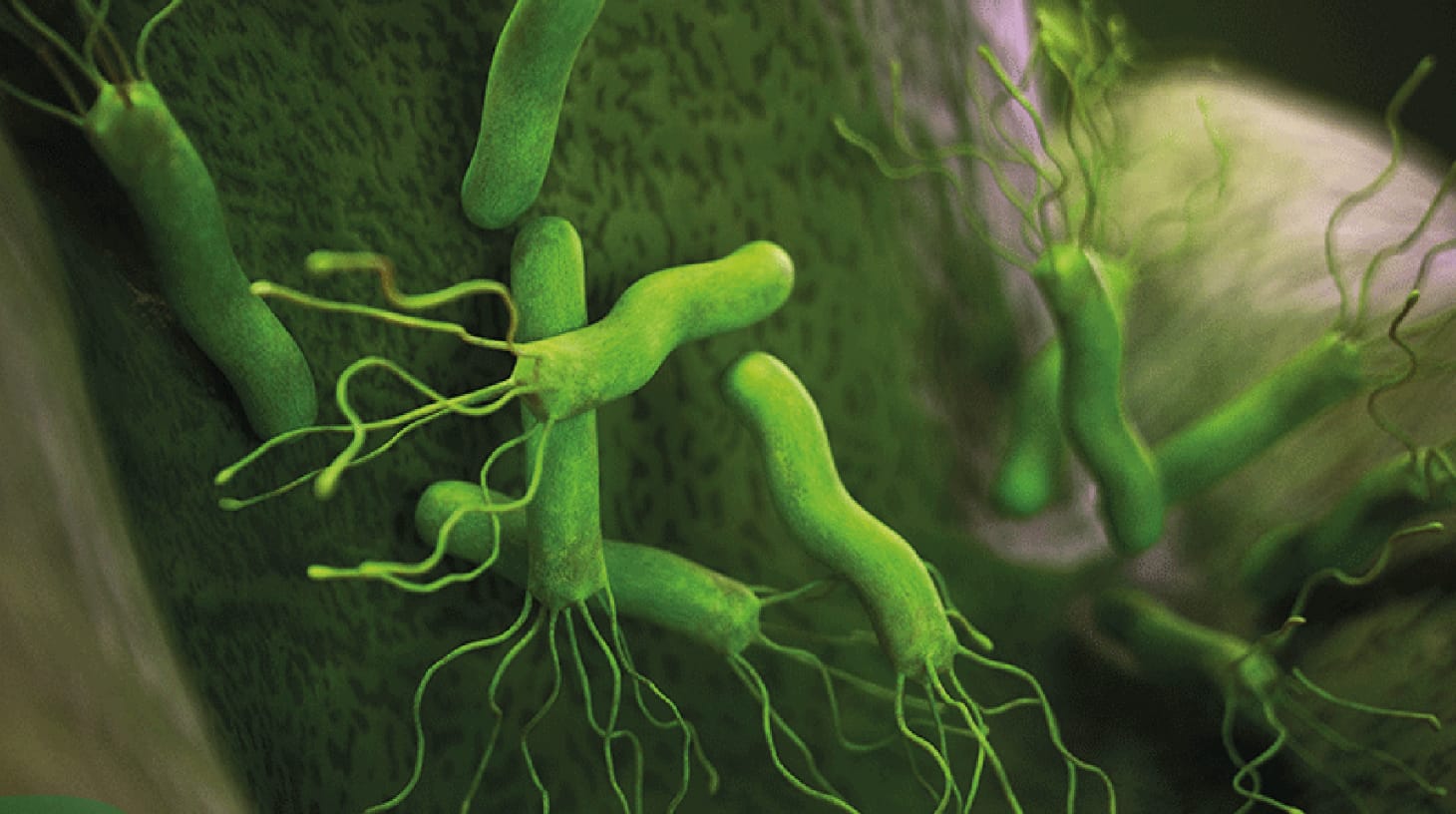 Helicobacter pylori: cuando el diagnóstico oportuno puede hacer una enorme diferencia