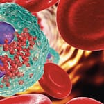 DRESS, una reacción alérgica no mediada por IgE