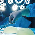 Linfoma anaplásico de células grandes asociado a implantes mamarios diagnosticado mediante punción por aguja fina. Caso clínico