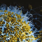 Sarampión: la enfermedad, epidemiología, historia y los programas de vacunación en Chile