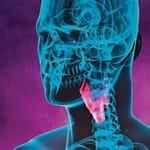 Hipotiroidismo Subclínico en poblaciones especiales: niños y adolescentes, embarazo y adultos mayores