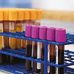 Estudio de inmunofenotipo por citometría de flujo para el diagnóstico de inmunodeficiencias primarias