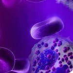 Síndrome hipereosinofílico idiopático