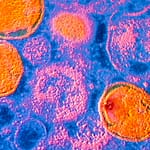 Susceptibilidad antimicrobiana en muestras urogenitales de Ureaplasma urealyticum, el principal agente en infección intramaniótica