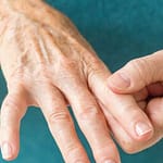 Anticuerpos contra el citoplasma del neutrófilo y actividad clínica en pacientes cubanos con artritis reumatoide