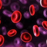 Técnicas de citogenética y biología molecular para el diagnóstico y seguimiento de la leucemia promielocítica