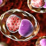 El diagnóstico de Infecciones de Transmisión Sexual por la técnica de biología molecular es la mejor estrategia para su diagnóstico oportuno y específico. Un caso clínico