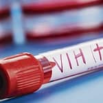 Seropositividad de VIH y factores asociados en donantes de un Banco de Sangre de La Ciudad de Medellín - Colombia, 2005 – 2018