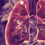 Tuberculosis Meníngea En Un Paciente Pediátrico: Reporte De Un Caso Clínico