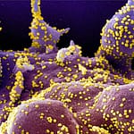 Cargas virales en pacientes trasplantados y genotipificación de Citomegalovirus
