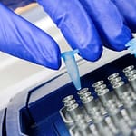 Uso de herramientas moleculares en el diagnóstico de parasitosis: PCR en tiempo real, iniciativas en enfermedad de Chagas