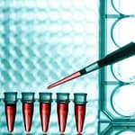 Predisposición genética para el cáncer de mama: genes BRCA1 y BRCA2