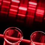 Introducción de la técnica PCR-RFLP para el diagnóstico de dos mutaciones en el gen VHL