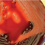 Aislamiento de Staphylococcus aureus hétero-resistente a vancomicina en Hospital Clínico Regional de Concepción, Chile