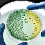 Infecciones Urinarias Complicadas