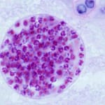 Técnica de Sedimentación Espontánea en Tubo para Diagnóstico de Enteroparasitosis en Centros de Salud de Primer Nivel