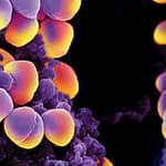 Staphylococcus aureus portador del gen mecA sensible a oxacilina (OS-MRSA): otro desafío para los laboratorios de microbiología