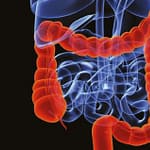 Diagnóstico y seguimiento de pacientes con sangre oculta positiva en heces fecales