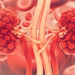 Utilidad de los parámetros urinarios en la enfermedad renal crónica avanzada