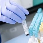 Tipos de residuos hospitalarios; forma de eliminación de los residuos hospitalarios