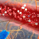 Anemia hemolítica autoinmune por anticuerpos calientes secundaria a hipertiroidismo. Revisión de la literatura