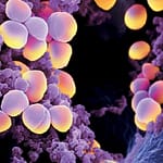 Vigilancia microbiológica de la resistencia bacteriana en Staphylococcus meticilina resistente. Hospital Universitario General Calixto García. Años 2015-2017