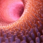 Biomarcadores en enfermedad inflamatoria intestinal: ¿sabe cómo utilizarlos?