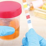 Significado de la proteinuria en el niño y adolescente. Consenso