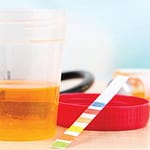 Validación del método enzimático para la determinación de creatinina en suero y orina