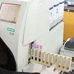 Hemoglobina Glicosilada por HPLC