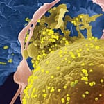 Transmisión parenteral del Virus Linfotrópico T Humano Tipo 1: ¿es un factor de riesgo a considerar para el desarrollo de la leucemia a Células T del adulto?