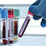 Sistema de Gestión de la Calidad para Laboratorios Clínicos Privados de Venezuela bajo la Norma Internacional ISO 15189:2012