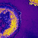 Aspectos inmunológicos en pacientes con VIH y terapia antirretroviral