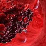 Fisiología plaquetaria, agregometría plaquetaria y su utilidad clínica