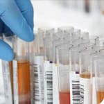 Interferencias por Fármacos en Análisis Clínicos: Hemoglobina Glicosilada (HbA c)