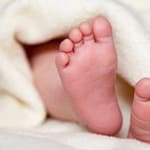 Déficit de biotinidasa o Déficit múltiple de carboxilasas