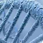 Estudio molecular de las formas familiares del síndrome de Noonan