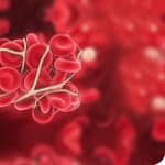 El laboratorio en Trombofilia