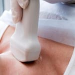 Autoanticuerpos Antitiroideos (TPOAb, TgAb y TRAb)