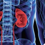 Estudio de exactitud diagnóstica que compara fosfatasa alcalina total con paratohormona intacta 1-84 para el diagnóstico de osteodistrofia renal de alto recambio en la insuficiencia renal crónica en hemodiálisis