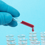 Documento de consenso para la determinación e informe del perfil lipídico en laboratorios clínicos españoles ¿Qué parámetros debe incluir un perfil lipídico básico?